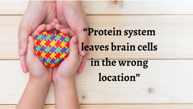 0510w4b Autism Brain Cells – caption still